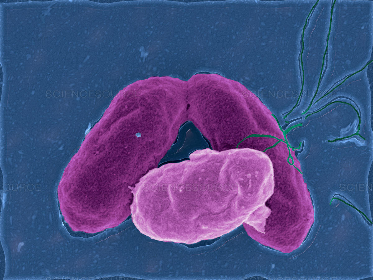 Paratyphoid: αιτία, συμπτώματα και θεραπεία