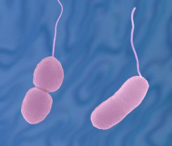 Τι είναι το Vibrio parahaemolyticus