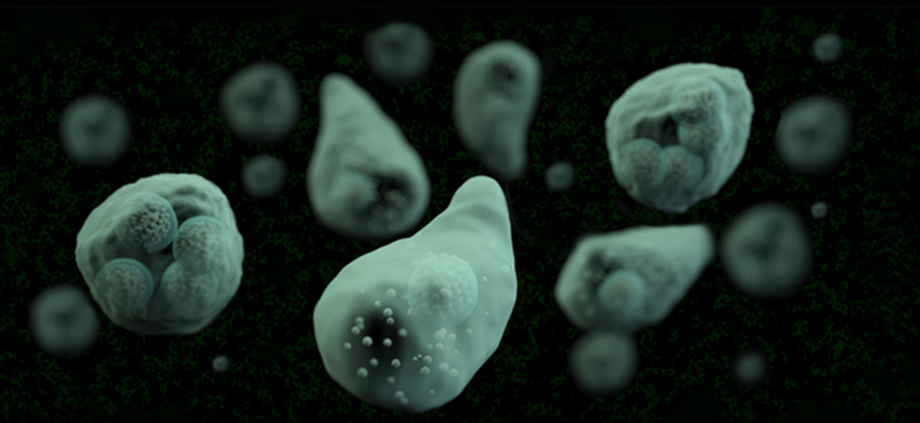 Amoebiasis λόγω λοίμωξης Entamoeba histolytica Amoebiasis λόγω λοίμωξης Entamoeba histolytica