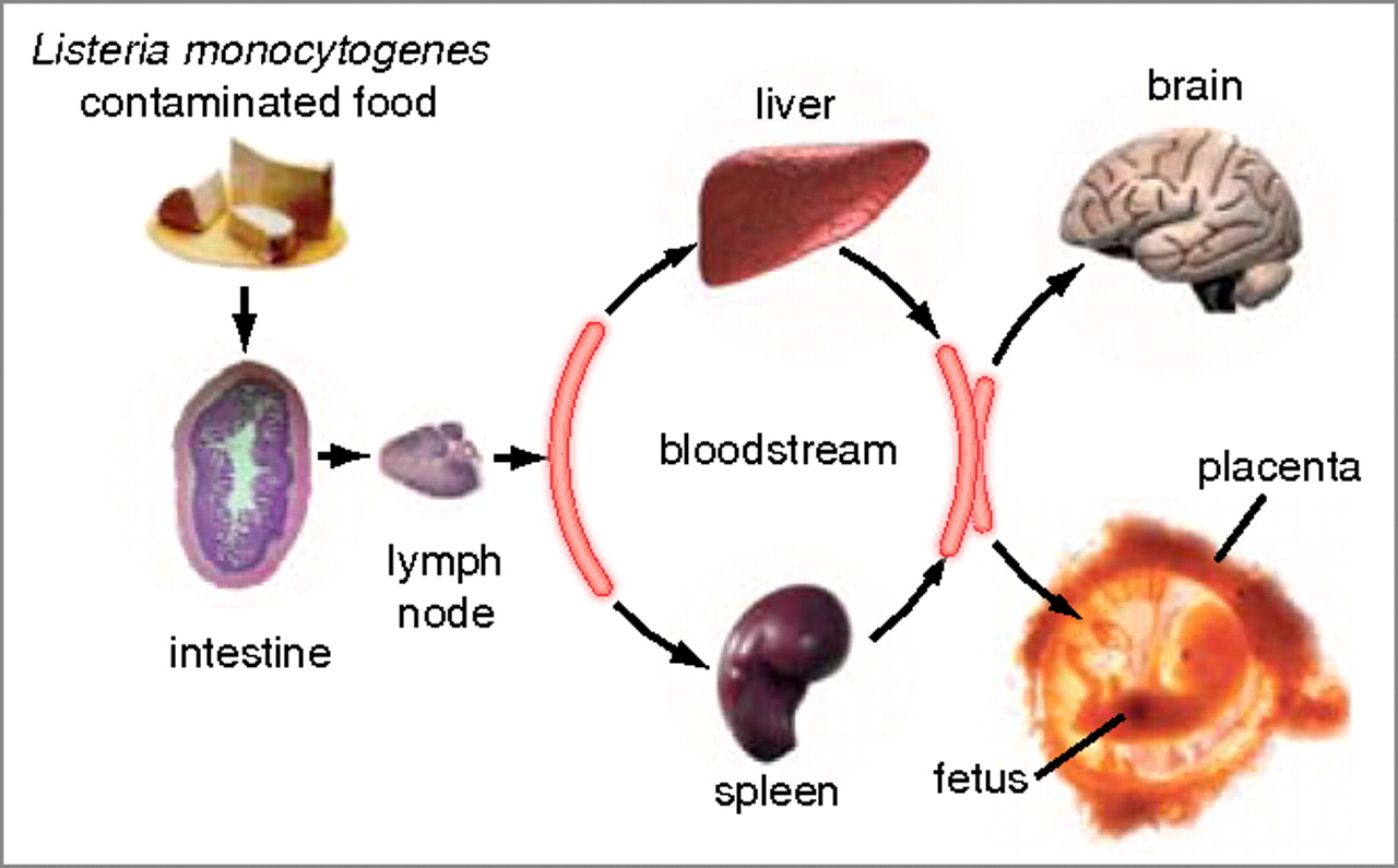 Μόλυνση από Listeria: συμπτώματα, αιτίες και θεραπεία