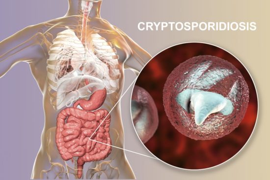 Μόλυνση από Cryptosporidium: συμπτώματα και θεραπεία