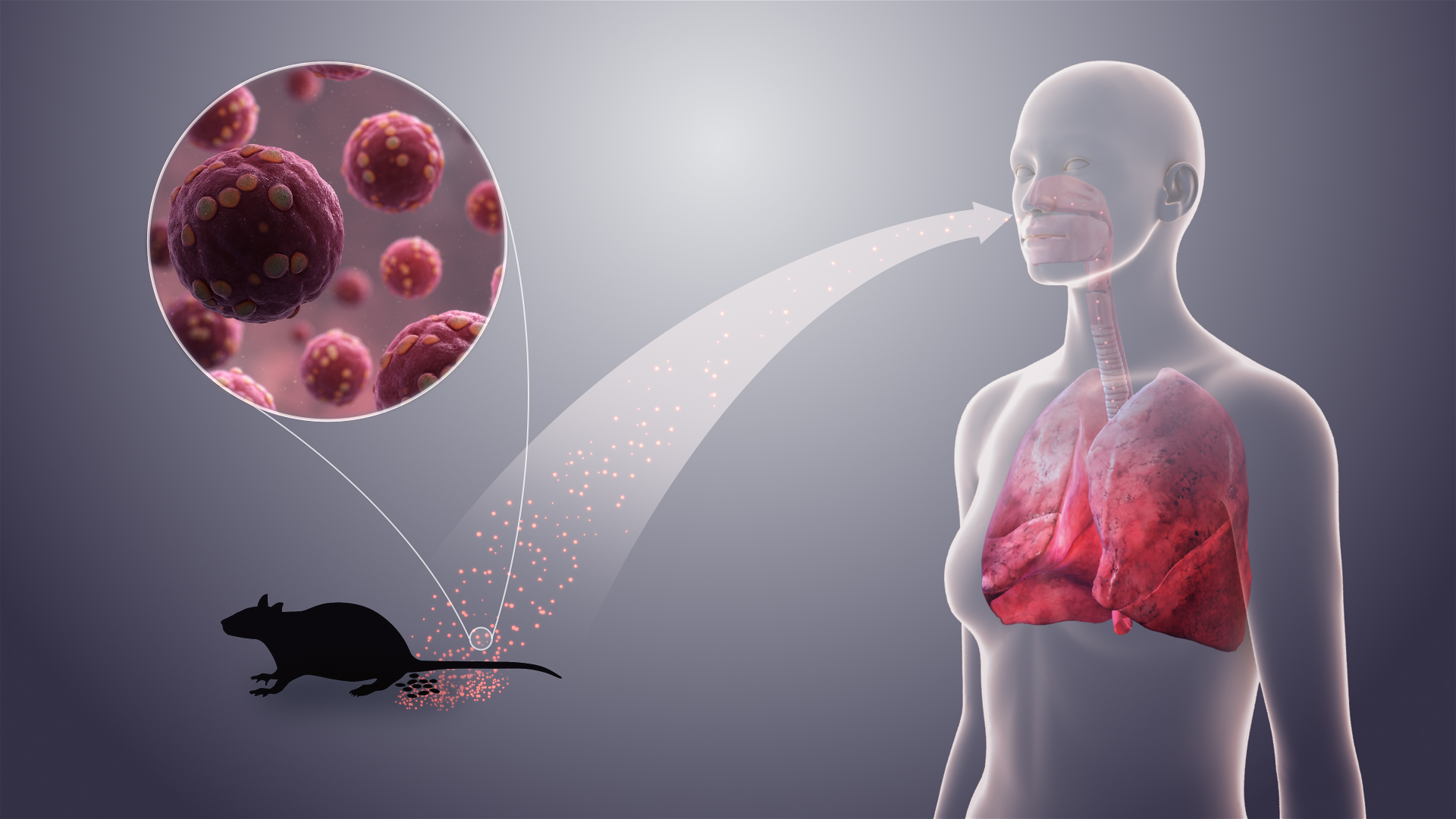Πνευμονικό Σύνδρομο Hantavirus (HPS)