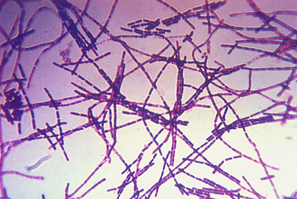 Βακτήριο Bacillus anthracis