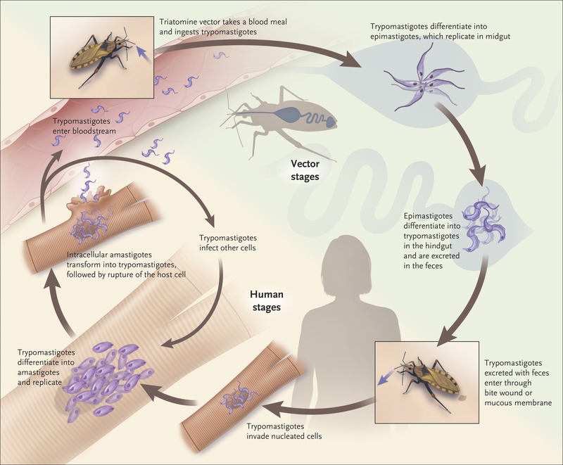 http://iatriko.net/wp-content/uploads/2021/01/nejmra1410150_f1.jpeg